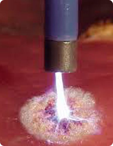 Plasma de Argônio